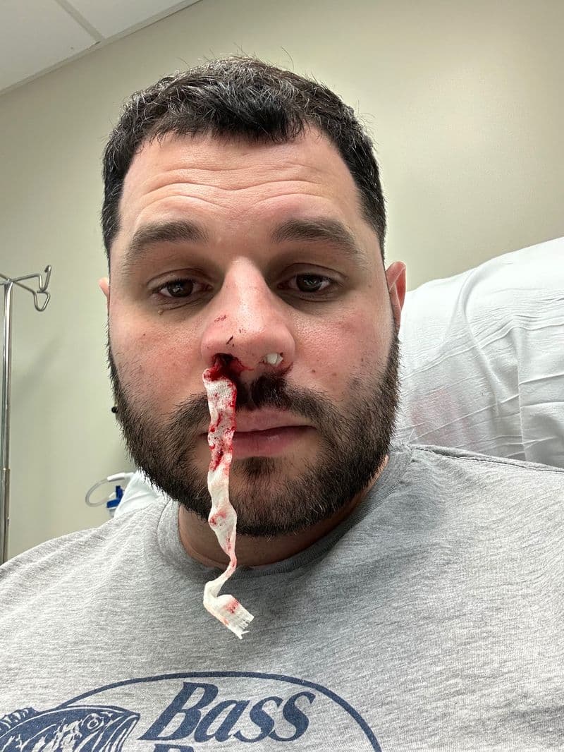 Ed Stiefel in the hospital in June 2023 after his stroke